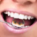 Tratamente ortodontice pentru adulti