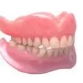 implant dentar sau proteza dentara?