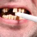 fumatul si parodontoza