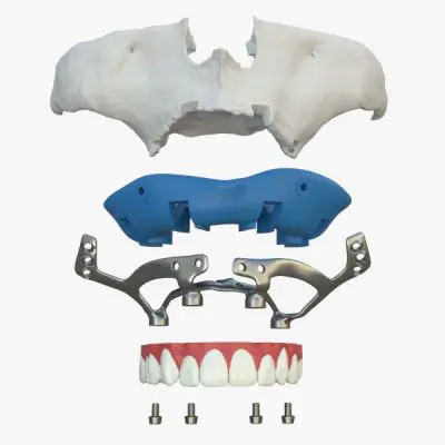 implanturi subperiostale edentatie totala maxilar