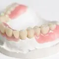 proteza dentara kemeny