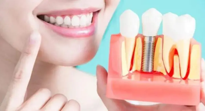 analize implant dentar