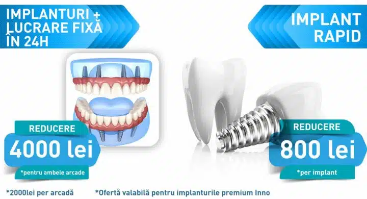 durata implant dentar