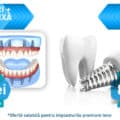 Proteza fixa cu 4 sau 6 implanturi dentare pret de o viata intreaga