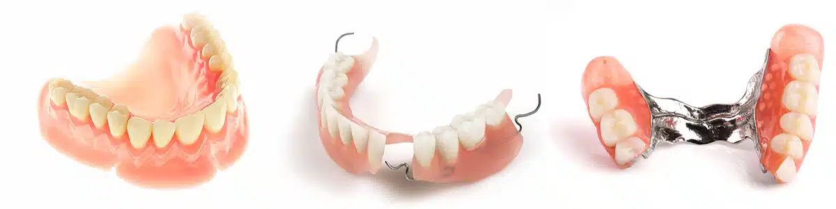 Proteze dentare totale sau partiale
